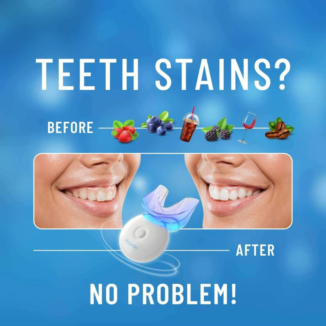 BrightSmile LED Teeth Whitening Kit