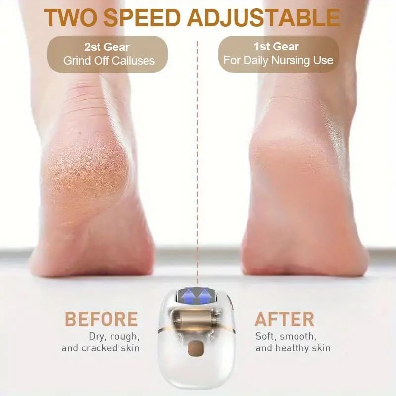 Dermafoot Callus Remover