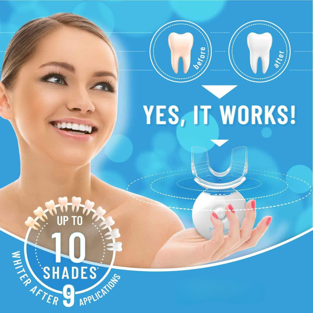 BrightSmile LED Teeth Whitening Kit