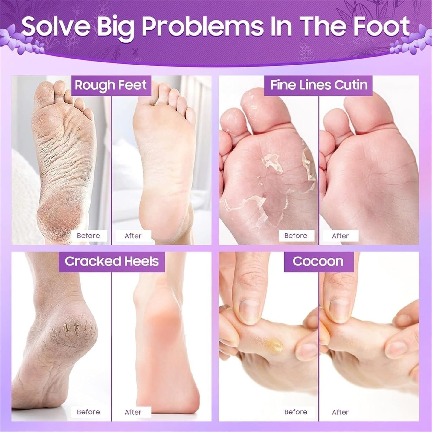 Baby Skin Foot Peel Mask