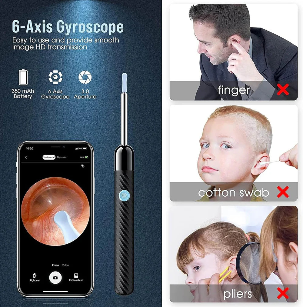 SmartbudĀ® Ear Care Kit