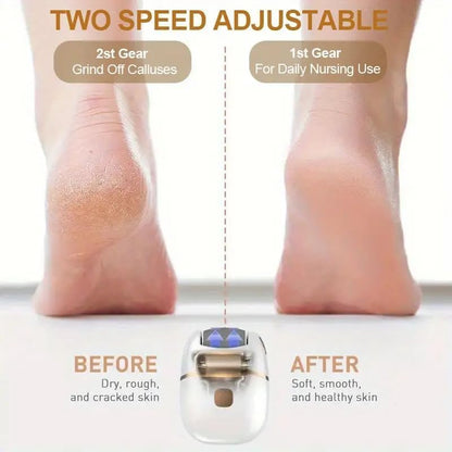 Dermafoot Callus Remover
