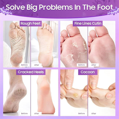 Baby Skin Foot Peel Mask