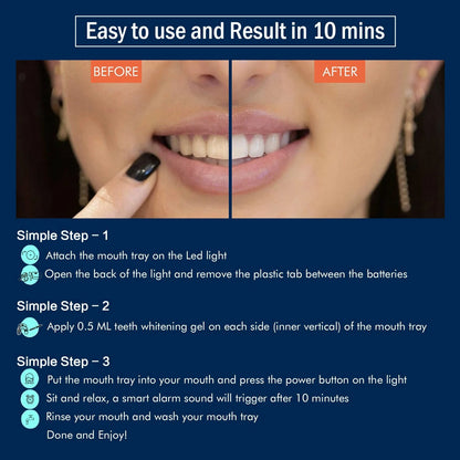 BrightSmile LED Teeth Whitening Kit